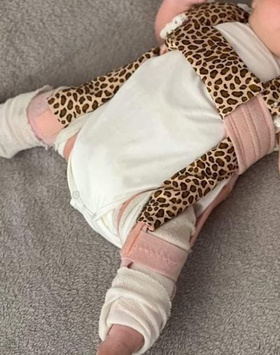 Pavlik bandage panter